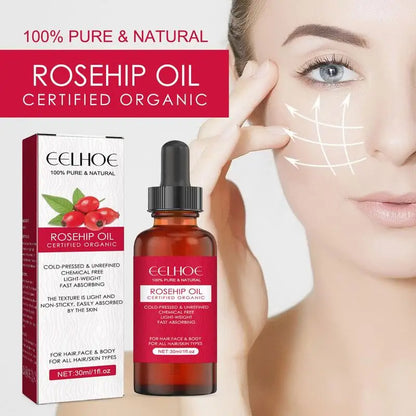 Rosehip Oil for Face & Skin – Organic, Pure Cold Pressed Rosehip Seed Oil for Gua Sha Massage & Acne Scars