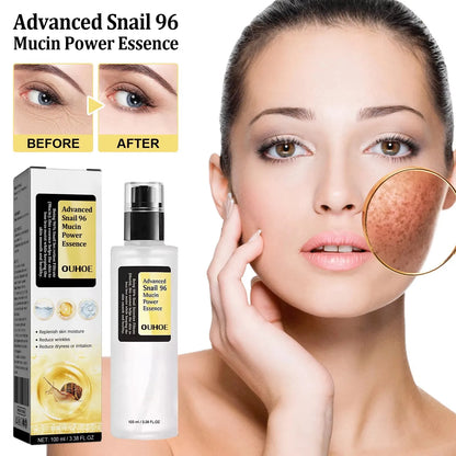 Snail Anti-Aging Serum - Advanced Moisturizing Skin Care | Firming, Tightening & Collagen Boosting Essence (100ml)