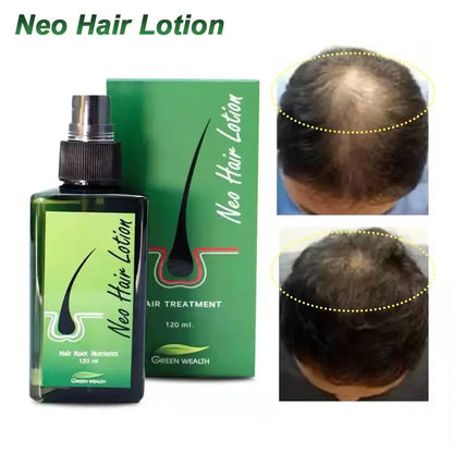 Product Title: Hair Growth Essential Oil Spray – Anti-Hair Loss Neo Hair Lotion for Men & Women (120ml)