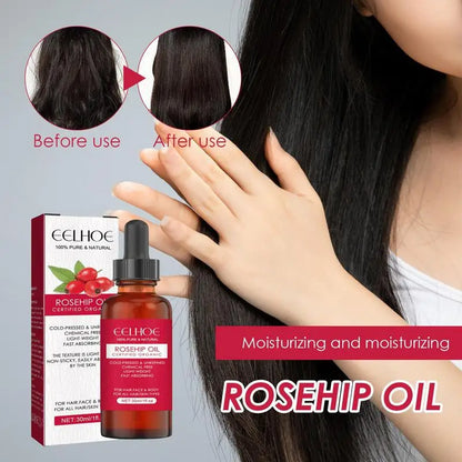 Rosehip Oil for Face & Skin – Organic, Pure Cold Pressed Rosehip Seed Oil for Gua Sha Massage & Acne Scars