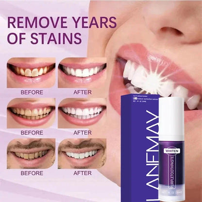 V34 Purple Teeth Whitening Toothpaste Remove Plaque Stains Cleaning Oral Hygiene Dental Bleach Tools Fresh Breath Beauty Health